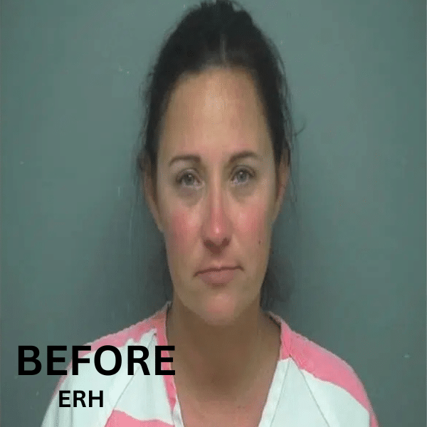 Before recovery journey at Eudaimonia Women’s Sober Living